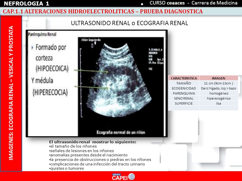 área hipoecoica trastornos de la próstata sistema urinario